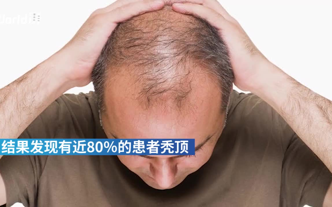 美国真实感染人数〃美国确诊超503万-第2张图片